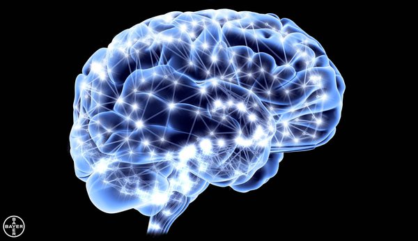 MSC Noticias - Esclerosis-Múltiple_cerebro Grupo Open Mind Salud 