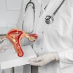 MSC Noticias - FOTO-VPH-es-la-principal-causa-de-cancer-de-cuello-uterino-150x150 Salud Ultimas Noticias 